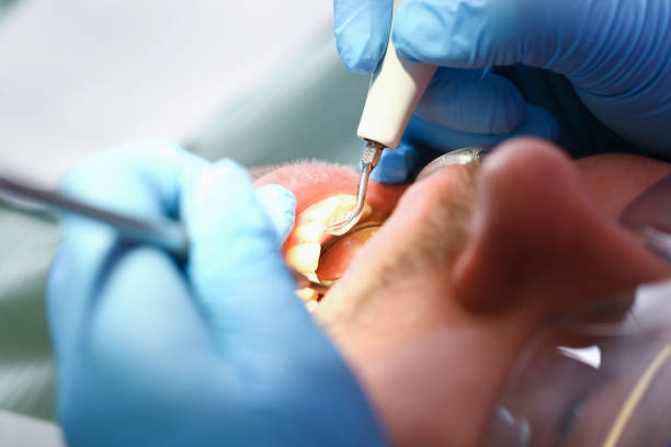 Best Emergency Dental Care for Trauma or Injury in Croom, MD